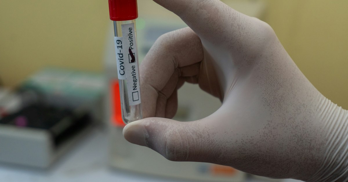 Jak przygotować się do badania „wolny testosteron”: zasady oddawania
